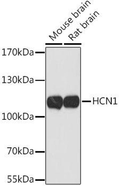 Signal Transduction Antibodies 2 Anti-HCN1 Antibody CAB16198