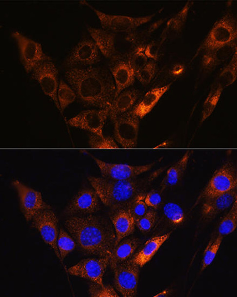 Signal Transduction Antibodies 2 Anti-HCN1 Antibody CAB16198