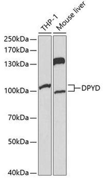 Cell Biology Antibodies 6 Anti-DPYD Antibody CAB1620