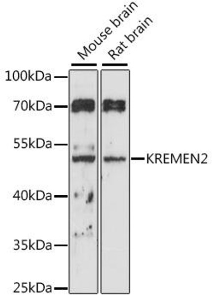 Metabolism Antibodies 3 Anti-KREMEN2 Antibody CAB16202