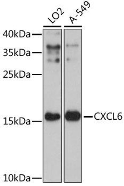 Cell Biology Antibodies 6 Anti-CXCL6 Antibody CAB16207