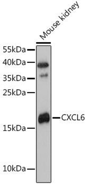 Cell Biology Antibodies 6 Anti-CXCL6 Antibody CAB16207