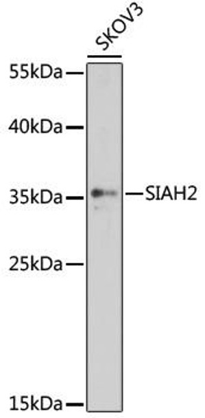 Cell Death Antibodies 1 Anti-SIAH2 Antibody CAB16211