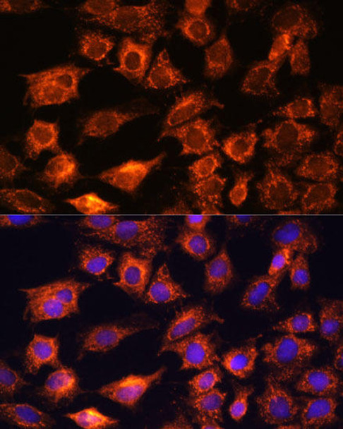 Epigenetics and Nuclear Signaling Antibodies 2 Anti-PTCD1 Antibody CAB16219