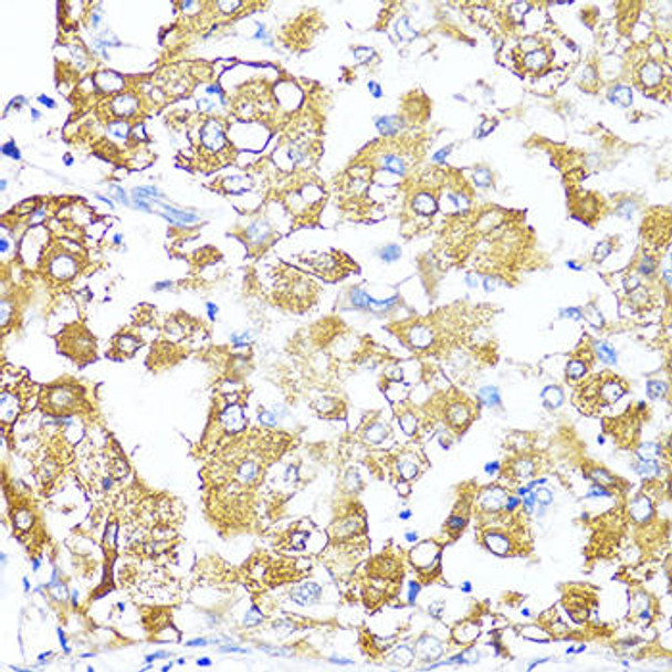 Cell Biology Antibodies 6 Anti-TGFB2 Antibody CAB16226