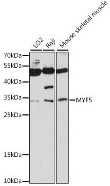 Developmental Biology Anti-MYF5 Antibody CAB16227