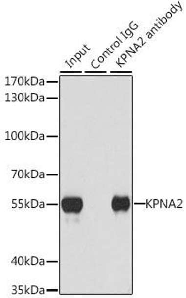 Immunology Antibodies 2 Anti-KPNA2 Antibody CAB1623