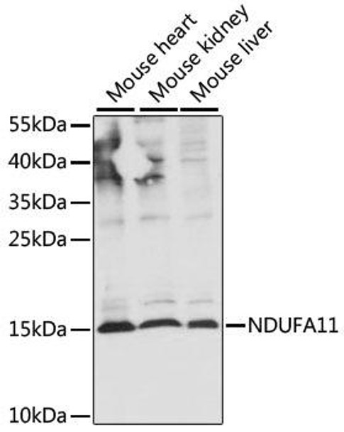Cell Biology Antibodies 6 Anti-NDUFA11 Antibody CAB16239