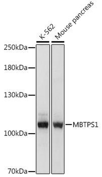 Metabolism Antibodies 3 Anti-MBTPS1 Antibody CAB16243