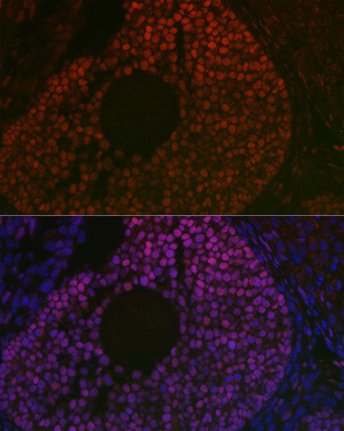 Developmental Biology Anti-FOXL2 Antibody CAB16244