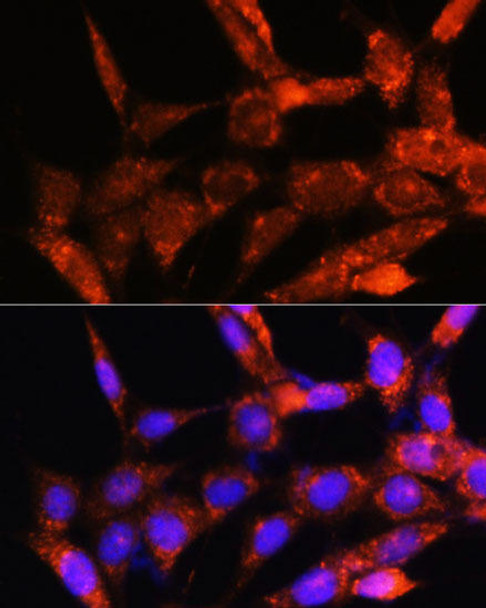 Cell Biology Antibodies 6 Anti-COX6C Antibody CAB16250