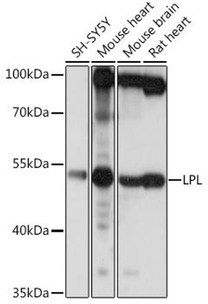 Metabolism Antibodies 3 Anti-LPL Antibody CAB16252