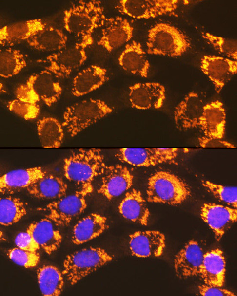 Metabolism Antibodies 3 Anti-ACSL1 Antibody CAB16253