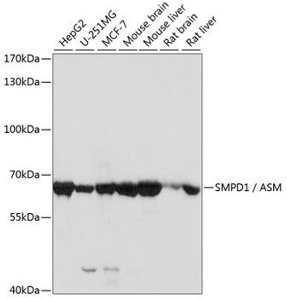 Cell Biology Antibodies 6 Anti-SMPD1 / ASM Antibody CAB16263