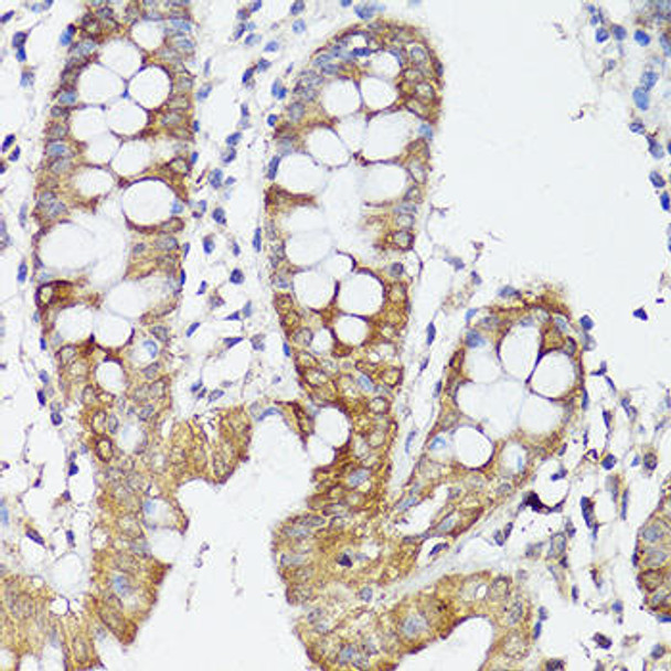 Cell Death Antibodies 1 Anti-APP Antibody CAB16265