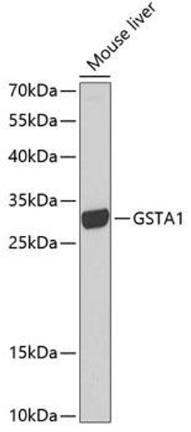 Cell Biology Antibodies 6 Anti-GSTA1 Antibody CAB1628