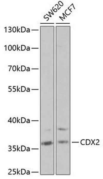 Epigenetics and Nuclear Signaling Antibodies 2 Anti-CDX2 Antibody CAB1629
