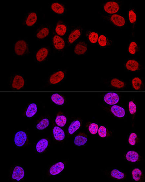 Epigenetics and Nuclear Signaling Antibodies 2 Anti-WT1 Antibody CAB16298