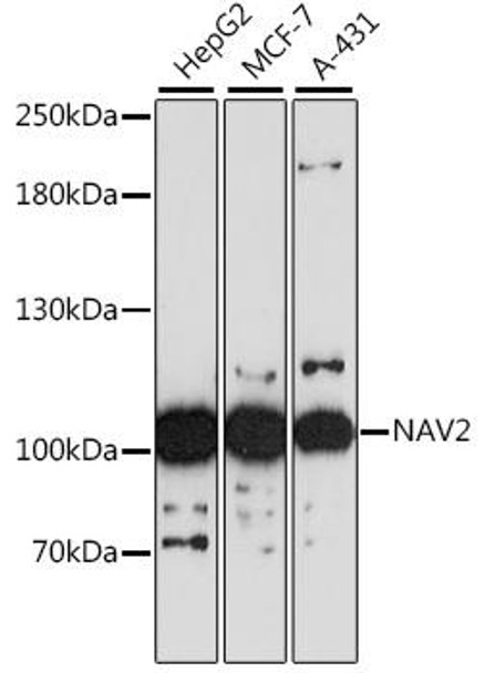 Cell Biology Antibodies 6 Anti-NAV2 Antibody CAB16300