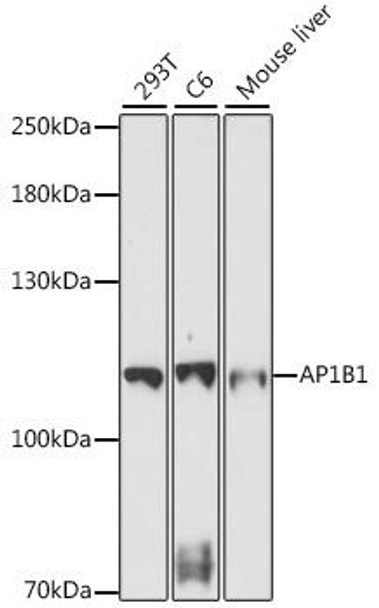 Cell Biology Antibodies 6 Anti-AP1B1 Antibody CAB16304