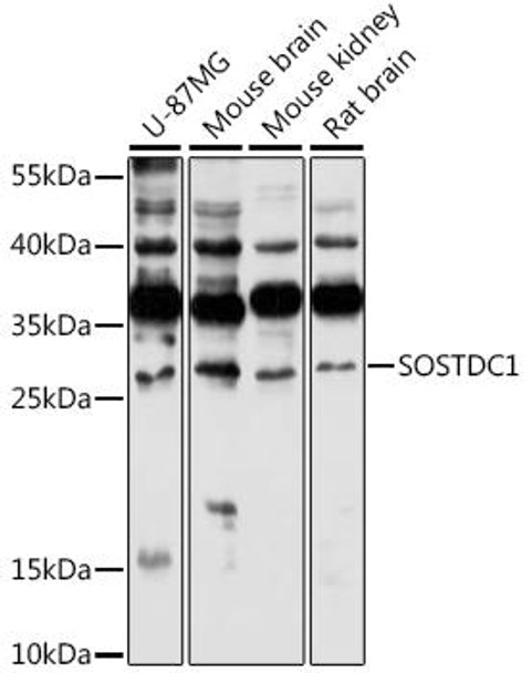 Metabolism Antibodies 2 Anti-SOSTDC1 Antibody CAB16315