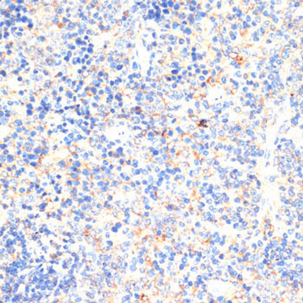 Immunology Antibodies 2 Anti-IL-2 Antibody CAB16317