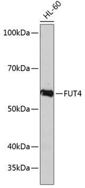Cell Biology Antibodies 7 Anti-FUT4 Antibody CAB16320