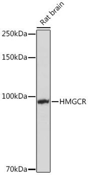 Metabolism Antibodies 2 Anti-HMGCR Antibody CAB1633