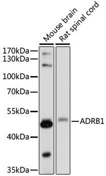 Neuroscience Anti-ADRB1 Antibody CAB16334