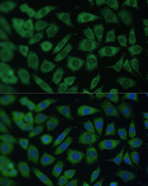 Cell Cycle Antibodies 1 Anti-ARL3 Antibody CAB16348