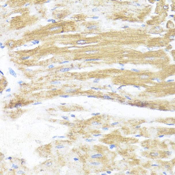 Metabolism Antibodies 2 Anti-ASMT Antibody CAB16349