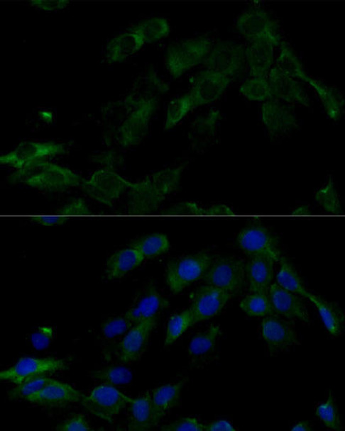 Immunology Antibodies 2 Anti-ATP6V0C Antibody CAB16350