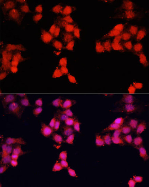 Metabolism Antibodies 2 Anti-ENO3 Antibody CAB16371