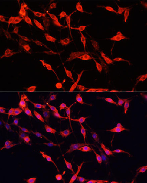 Metabolism Antibodies 2 Anti-ENO3 Antibody CAB16371