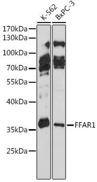 Cell Biology Antibodies 7 Anti-FFAR1 Antibody CAB16379