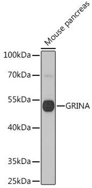 Cell Biology Antibodies 7 Anti-GRINA Antibody CAB16380