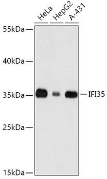 Signal Transduction Antibodies 2 Anti-IFI35 Antibody CAB16384