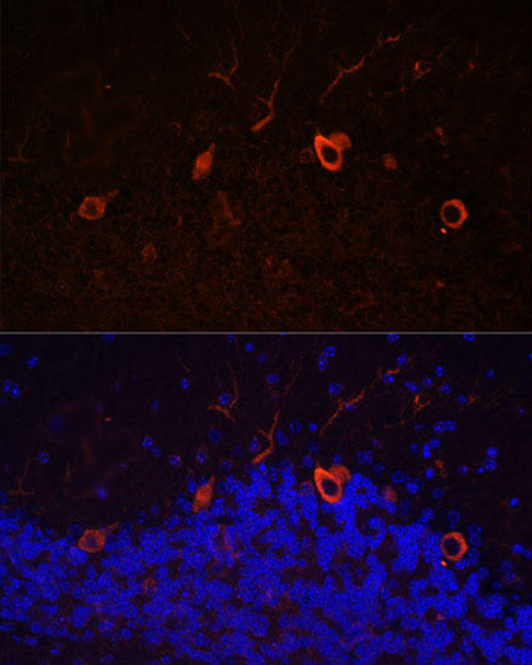 Cell Biology Antibodies 7 Anti-KAL1 Antibody CAB16389