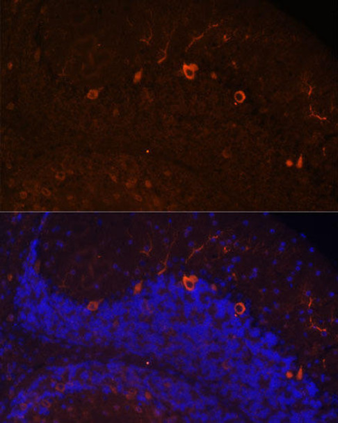 Cell Biology Antibodies 7 Anti-KAL1 Antibody CAB16389