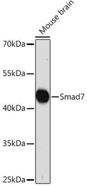 Epigenetics and Nuclear Signaling Antibodies 2 Anti-Smad7 Antibody CAB16396