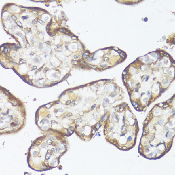 Epigenetics and Nuclear Signaling Antibodies 2 Anti-Smad7 Antibody CAB16396