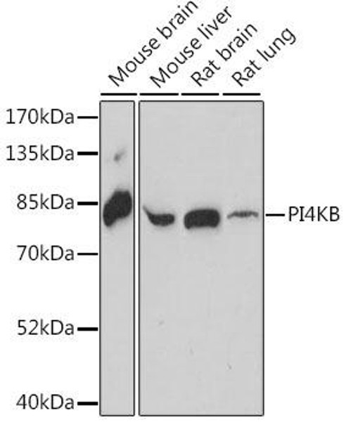 Immunology Antibodies 2 Anti-PI4KB Antibody CAB16416