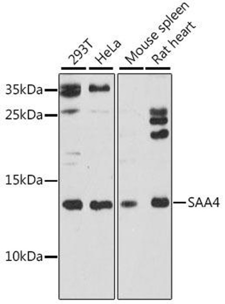 Immunology Antibodies 2 Anti-SAA4 Antibody CAB16428