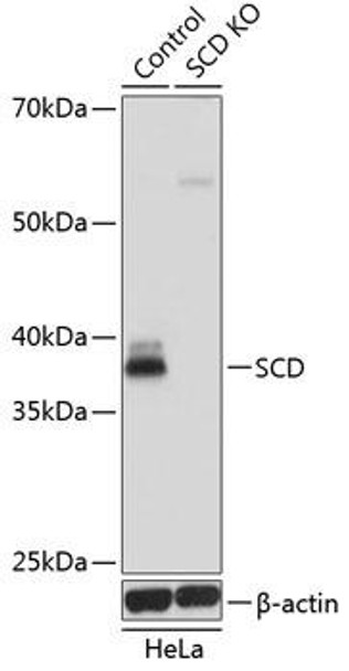 KO Validated Antibodies 1 Anti-SCD Antibody CAB16429KO Validated