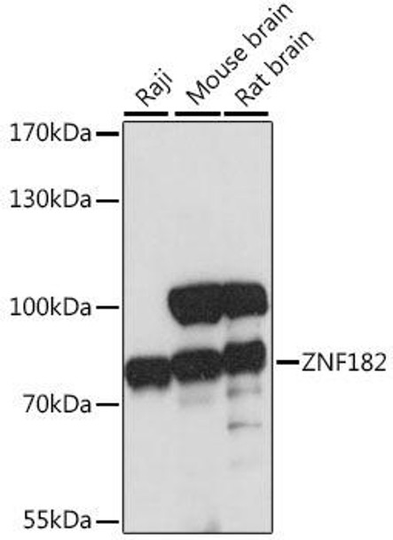 Epigenetics and Nuclear Signaling Antibodies 2 Anti-ZNF182 Antibody CAB16445