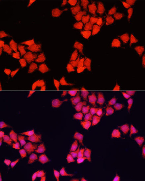 Developmental Biology Anti-FXR1 Antibody CAB16447