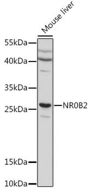 Cell Biology Antibodies 7 Anti-NR0B2 Antibody CAB16454