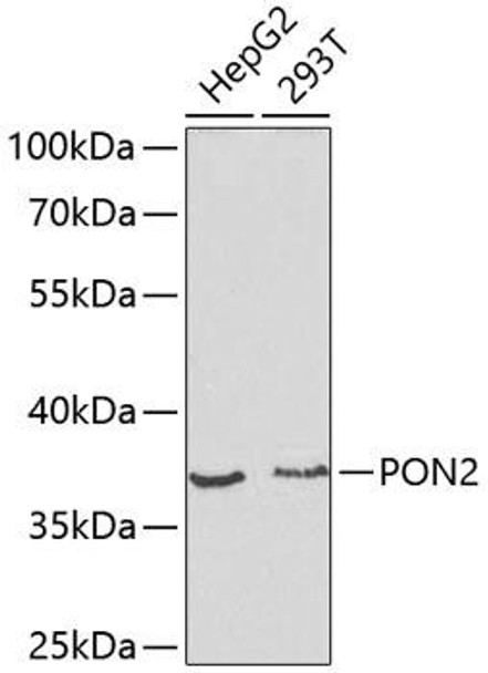 Cell Biology Antibodies 7 Anti-PON2 Antibody CAB1646