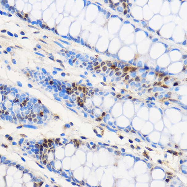 Epigenetics and Nuclear Signaling Antibodies 2 Anti-ZNF263 Antibody CAB16477