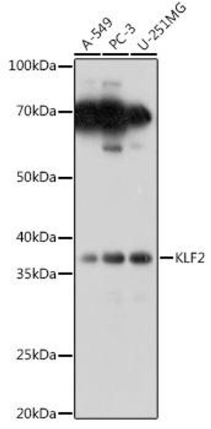 Epigenetics and Nuclear Signaling Antibodies 2 Anti-KLF2 Antibody CAB16480